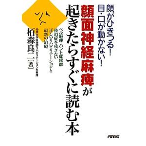 顔面神経麻痺 後遺症