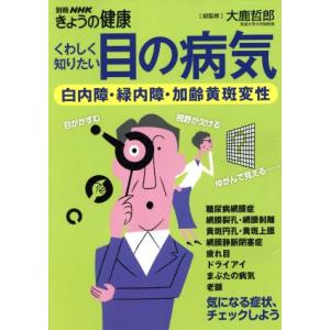 くわしく知りたい目の病気 白内障・緑内障・加齢黄斑変性 別冊NHKきょうの健康/健康・家庭医学