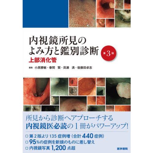 内視鏡所見のよみ方と鑑別診断　上部消化管 / 小原勝敏