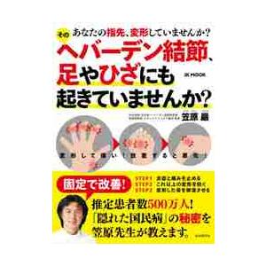 そのヘバーデン結節、足やひざにも起きていませんか？　あなたの指先、変形していませんか？ / 笠原　巖　著｜books-ogaki