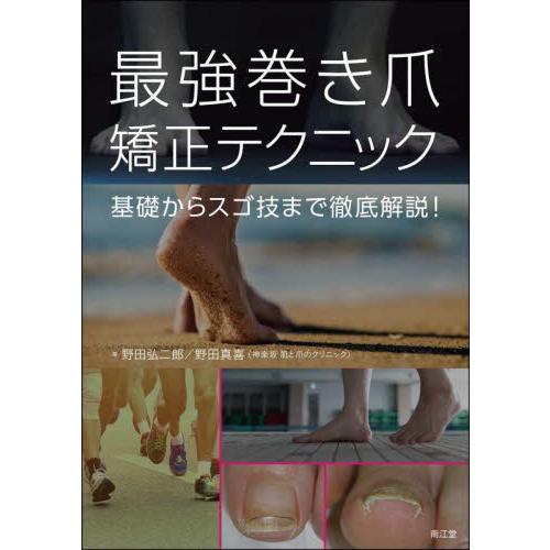 最強巻き爪矯正テクニック　基礎からスゴ技まで徹底解説！ / 野田　弘二郎　著