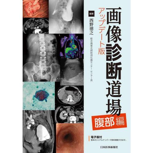 画像診断道場　アップデート版　腹部編 / 西野徳之　編著