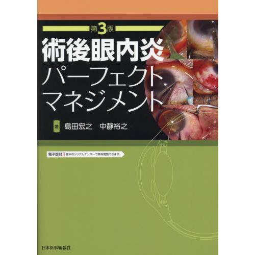 術後眼内炎パーフェクトマネジメント / 島田宏之