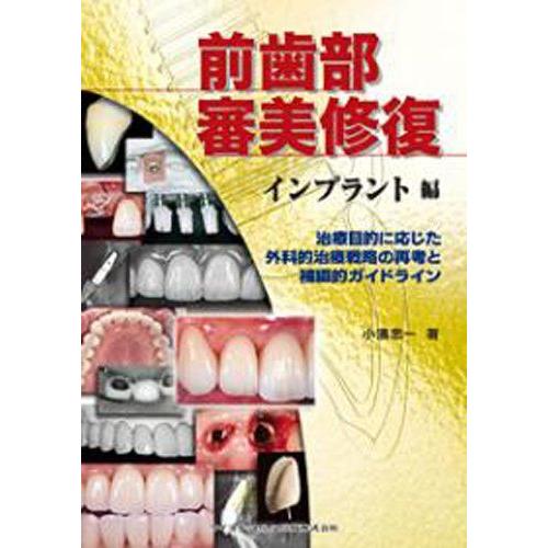 [A01323770]前歯部審美修復 インプラント編