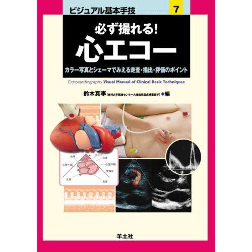 ビジュアル基本手技 7-カラー写真とシェーマでみえる走査・描出・評価のポイ 必ず撮れる!心エコー