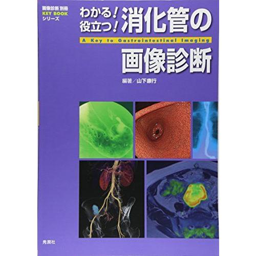 わかる! 役立つ! 消化管の画像診断 (画像診断別冊 KEYBOOK)