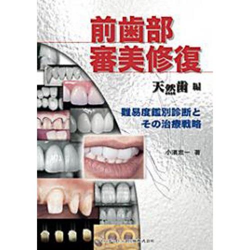 [A11234215]前歯部審美修復 天然歯編 ―難易度鑑別診断とその治療戦略