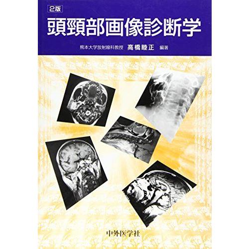 [A11616989]頭頚部画像診断学 高橋 睦正