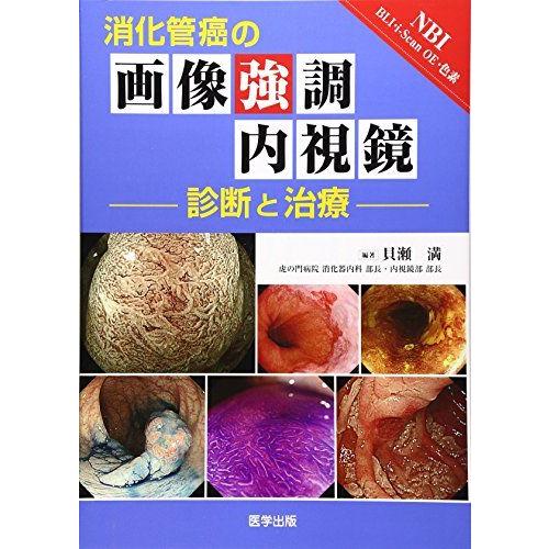 消化管癌の画像強調内視鏡 診断と治療 [単行本] 貝瀬 満