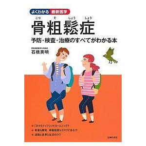 骨粗鬆症 予防・検査・治療のすべてがわかる本/石橋英明