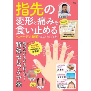 指先の変形と痛みを食い止める ヘバーデン結節の症状を和らげる本/高橋嗣明