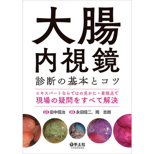 大腸内視鏡診断の基本とコツ エキスパートならではの見かた・着眼点で現場の疑問をすべて解決/田中信治/...