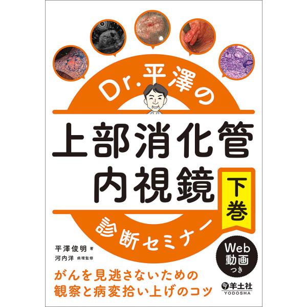 Dr.平澤の上部消化管内視鏡診断セミナー がんを見逃さないための観察と病変拾い上げのコツ 下巻/平澤...