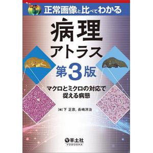 正常画像と比べてわかる病理アトラス マクロとミクロの対応で捉える病態/下正宗/長嶋洋治｜boox