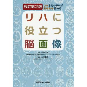 リハに役立つ脳画像 コツさえわかればあなたも読める/大村優慈/酒向正春