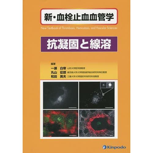 新・血栓止血血管学 抗凝固と線溶/一瀬白帝/丸山征郎/和田英夫