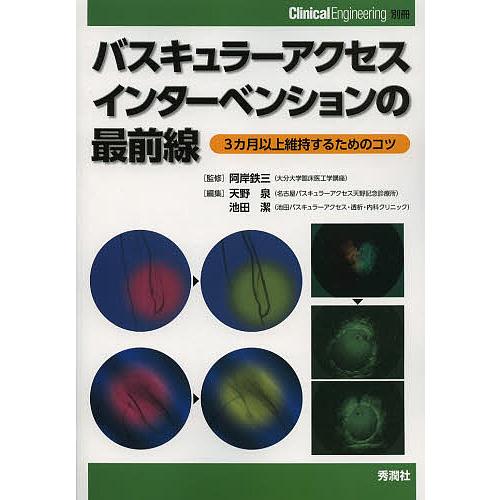 バスキュラーアクセスインターベンションの最前線 3カ月以上維持するためのコツ/阿岸鉄三/天野泉/池田...