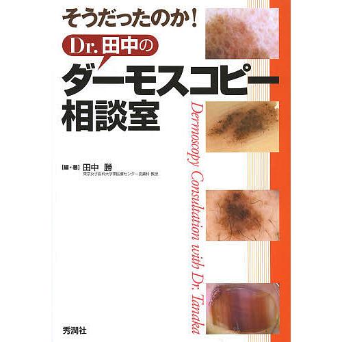 そうだったのか!Dr.田中のダーモスコピー相談室/田中勝