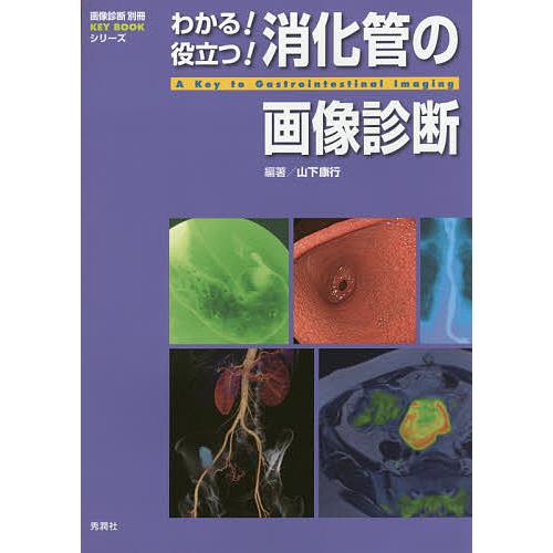 わかる!役立つ!消化管の画像診断/山下康行