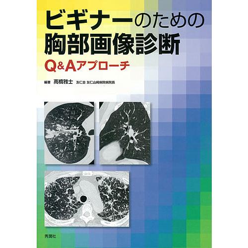ビギナーのための胸部画像診断 Q&amp;Aアプローチ/高橋雅士