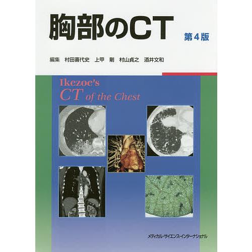 胸部のCT/村田喜代史/上甲剛/村山貞之
