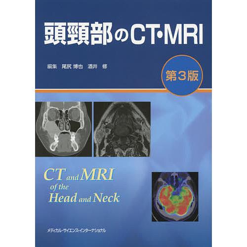 頭頸部のCT・MRI/尾尻博也/酒井修