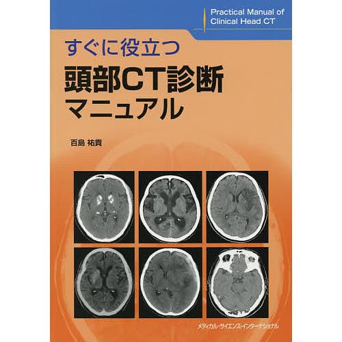 すぐに役立つ頭部CT診断マニュアル/百島祐貴