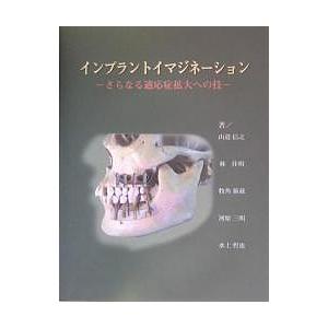 インプラントイマジネーション さらなる適応症拡大への技/山道信之｜boox