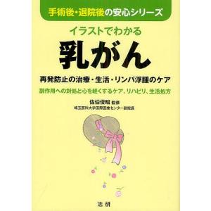 イラストでわかる乳がん　再発防止の治療・生活・リンパ浮腫のケア　副作用への対処と心を軽くするケア、リハビリ、生活処方/佐伯俊昭