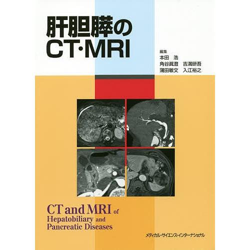 肝胆膵のCT・MRI/本田浩/角谷眞澄/吉満研吾