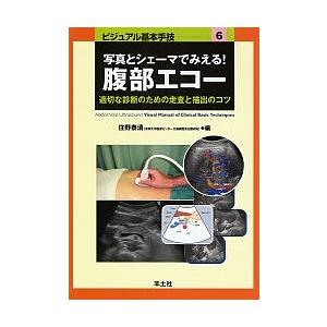 写真とシェーマでみえる!腹部エコー 適切な診断のための走査と描出のコツ/住野泰清