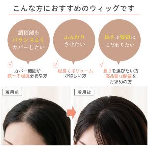 総手植え レミー 人毛100% トップカバー ...の詳細画像1