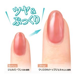 ジェルミーワン スターターボックス (gelm...の詳細画像2