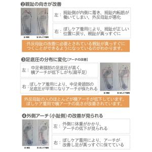 【日本製】 ぼしケア 外反母趾対策 5本指ソッ...の詳細画像5