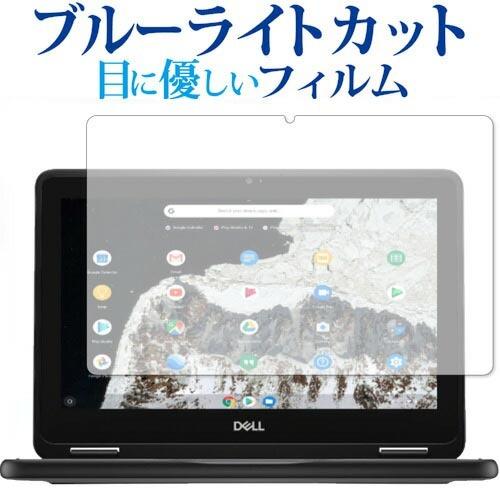 DELL Chromebook 11 3100 2-in-1 専用 ブルーライトカット 反射防止 液...