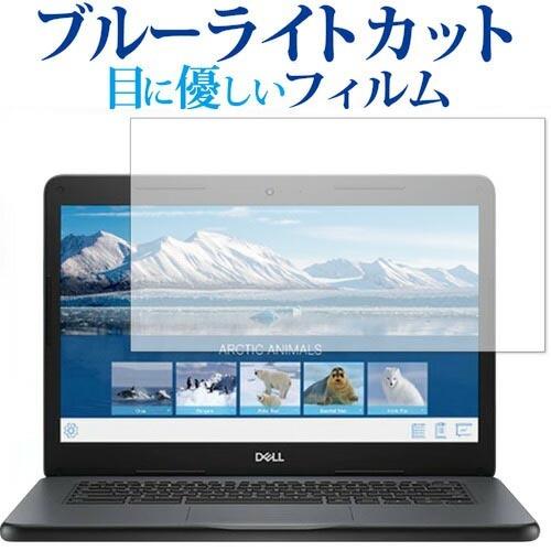 DELL Chromebook 14 3400 Education 専用 ブルーライトカット 反射防...