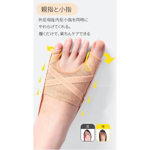 【即納】外反母趾サポーター 内反小趾 足指サポ...の詳細画像1