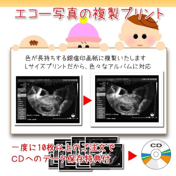 エコー写真 複製 プリント 長期保存用プリント エコー 写真保存