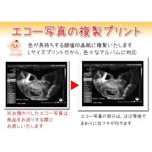 エコー写真 複製 プリント 長期 保存 プリン...の詳細画像2