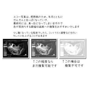 エコー写真 複製 プリント 長期 保存 プリン...の詳細画像3