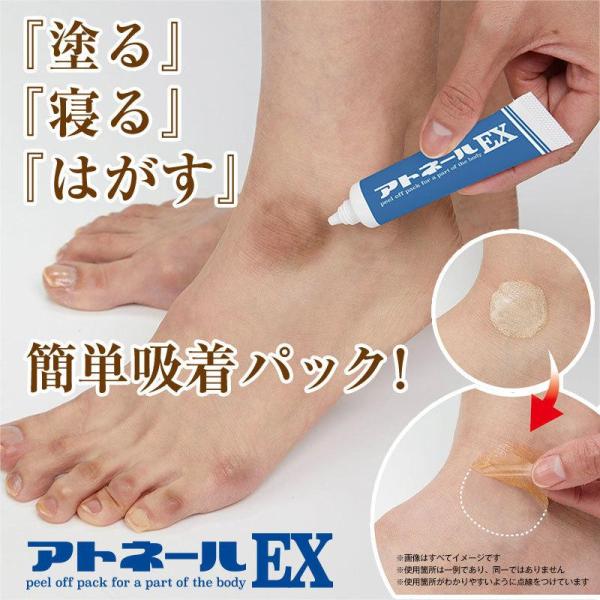 【お得10個セット】 アトネールEX 15g 足の角質ケア クリーム パック 足 黒ずみ 角質 硬化...