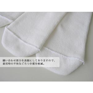 パイル 義手・義足用ソケットカバー 2枚入 日...の詳細画像3