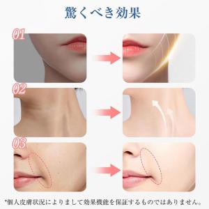 美顔ローラー EMS ほうれい線 アクティブ ...の詳細画像4