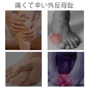 外反母趾 足指 付け根 親指 サポーター パッ...の詳細画像1