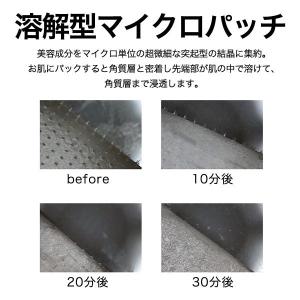 【韓国コスメ】マイクロニードル 大人の肌色集中...の詳細画像5