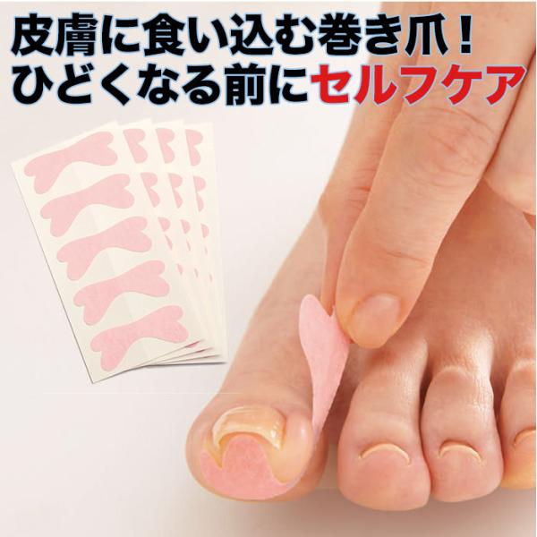 巻き爪 ケア テーピング 医療用テープ 巻爪ガード  使い捨て 日本製  予防  ガード 美容 巻爪...