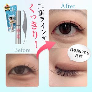 二重 ふたえのり バレにくい 湘南美容 アイリ...の詳細画像3