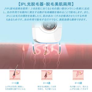 【クーポンで10799円】IPL脱毛器 男女兼...の詳細画像4