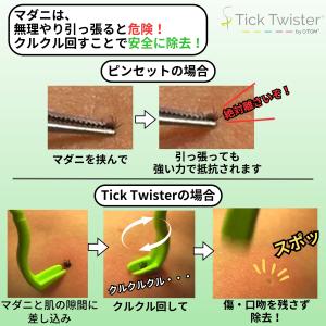【正規品】Tick Twister ClipB...の詳細画像2