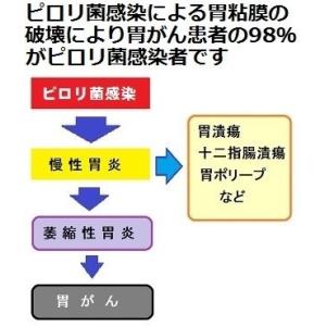 【郵送検査キットセンター】ピロリ菌検査キット・...の詳細画像4